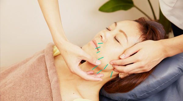 Ligamentitia® Facial and Scalp Acupuncture