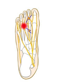 ブログイメージ