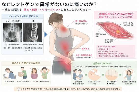 ブログイメージ
